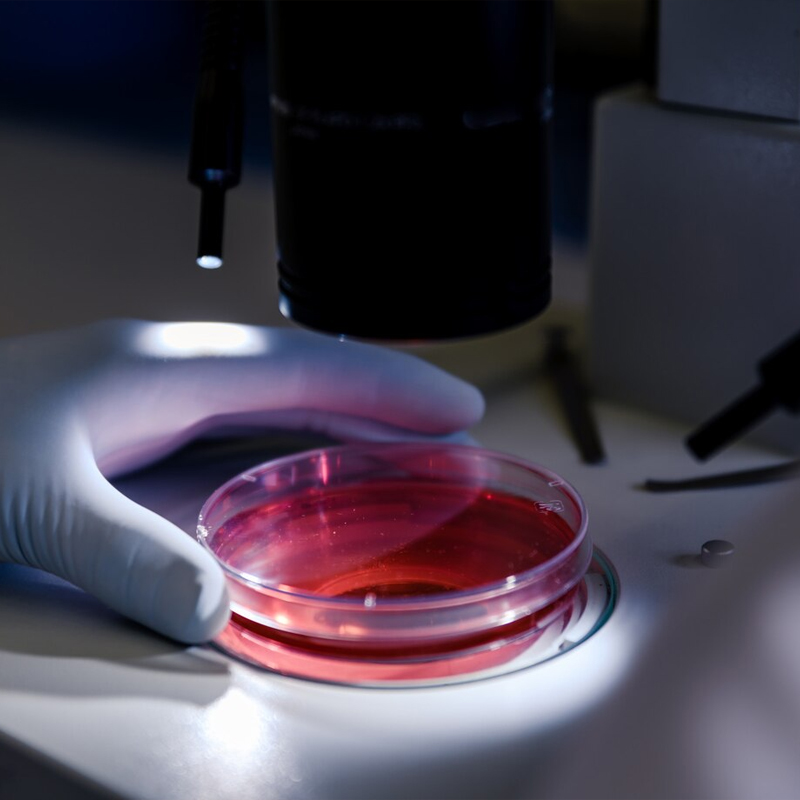 Analisis clinicos Farmacia Casaudoumecq Valencia Analisis clinicos Farmacia Casaudoumecq Valencia
